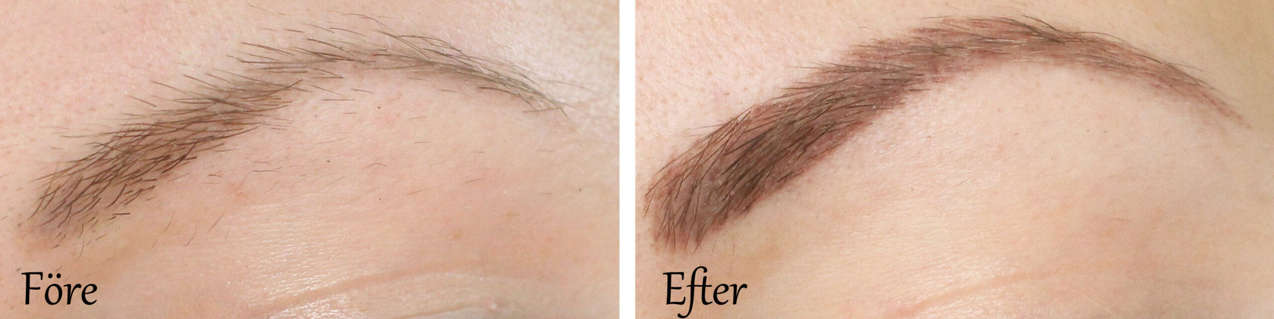 before-after-cosmetic-tattoo-eyebrows