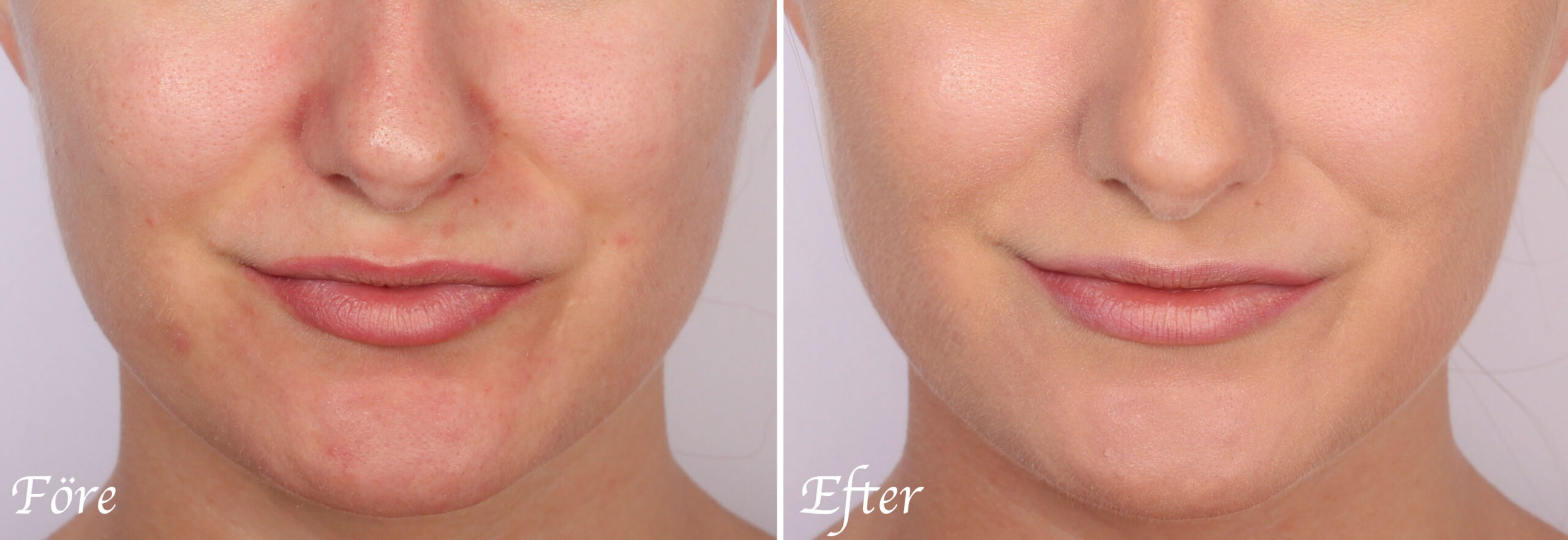 make-up-away-red-areas-in-the-face-before-after