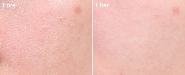 Imprimación en polvo