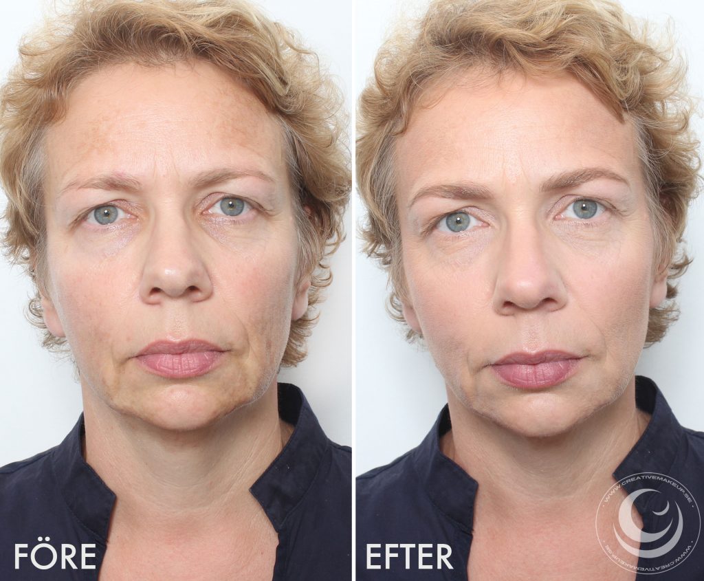 Maquilla manchas de pigmento antes y después