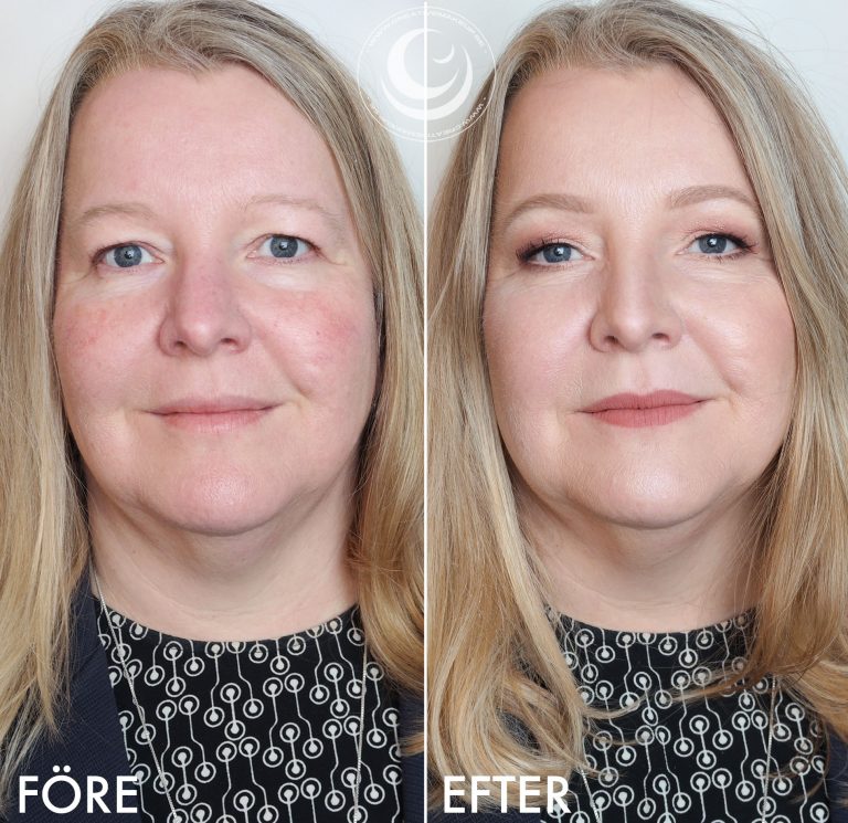 Maquillaje sobre pieles rojas y secas